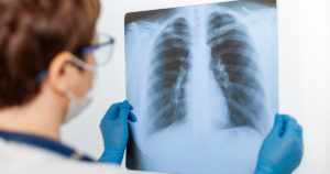 Philadelphia Mesothelioma Lawyers at Shein Law Fight for the Rights of Those Who Have Been Negligently Exposed to Asbestos.