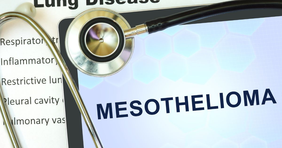 Stunning How Long Does Mesothelioma Take To Develop Picture Photography Stunning How Long Does Mesothelioma Take To Develop Picture Photography