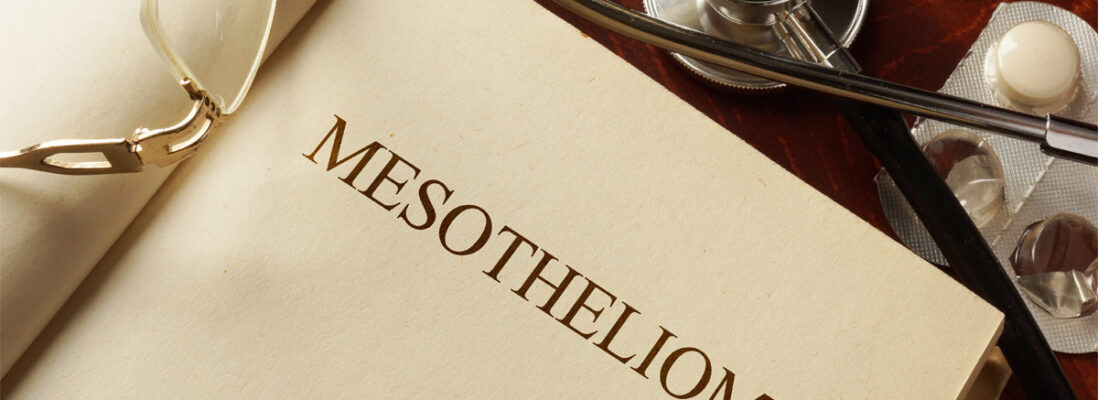 Contact a Philadelphia Mesothelioma Lawyer at Shein Law to Discuss Your Case